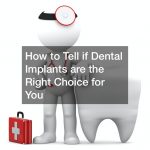 dental implants